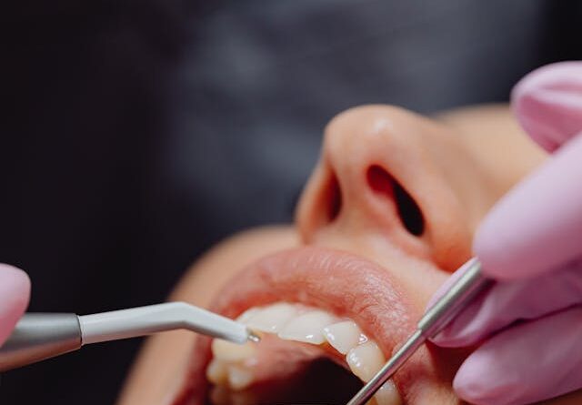 Implanty zębów - etapy leczenia