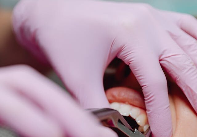 Jak wygląda wizyta u endodonty?