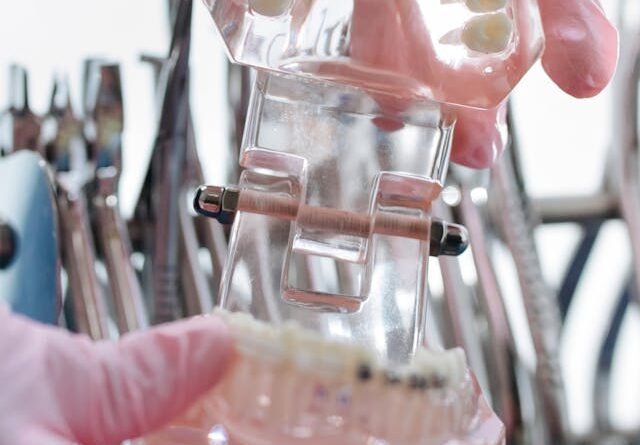 Jakie wady zgryzu leczy ortodonta?